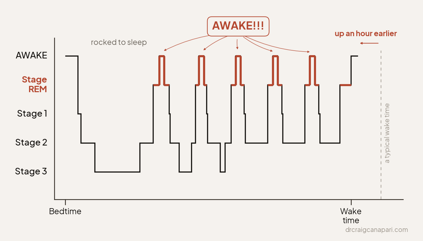 Hypnogram of a toddler who is rocked to sleep. He takes longer to fall asleep, wakes fully five times during the night, each time out of REM sleep, and is up for the day about an hour earlier than a typical wake time.