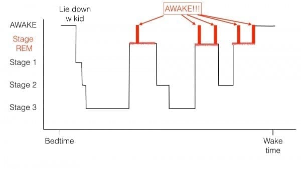 Hypnogram of sleep stages in infant with inappropriate sleep onset associations showing prolonged sleep period at beginning of night, multiple awakenings during REM sleep, and an early AM awakening